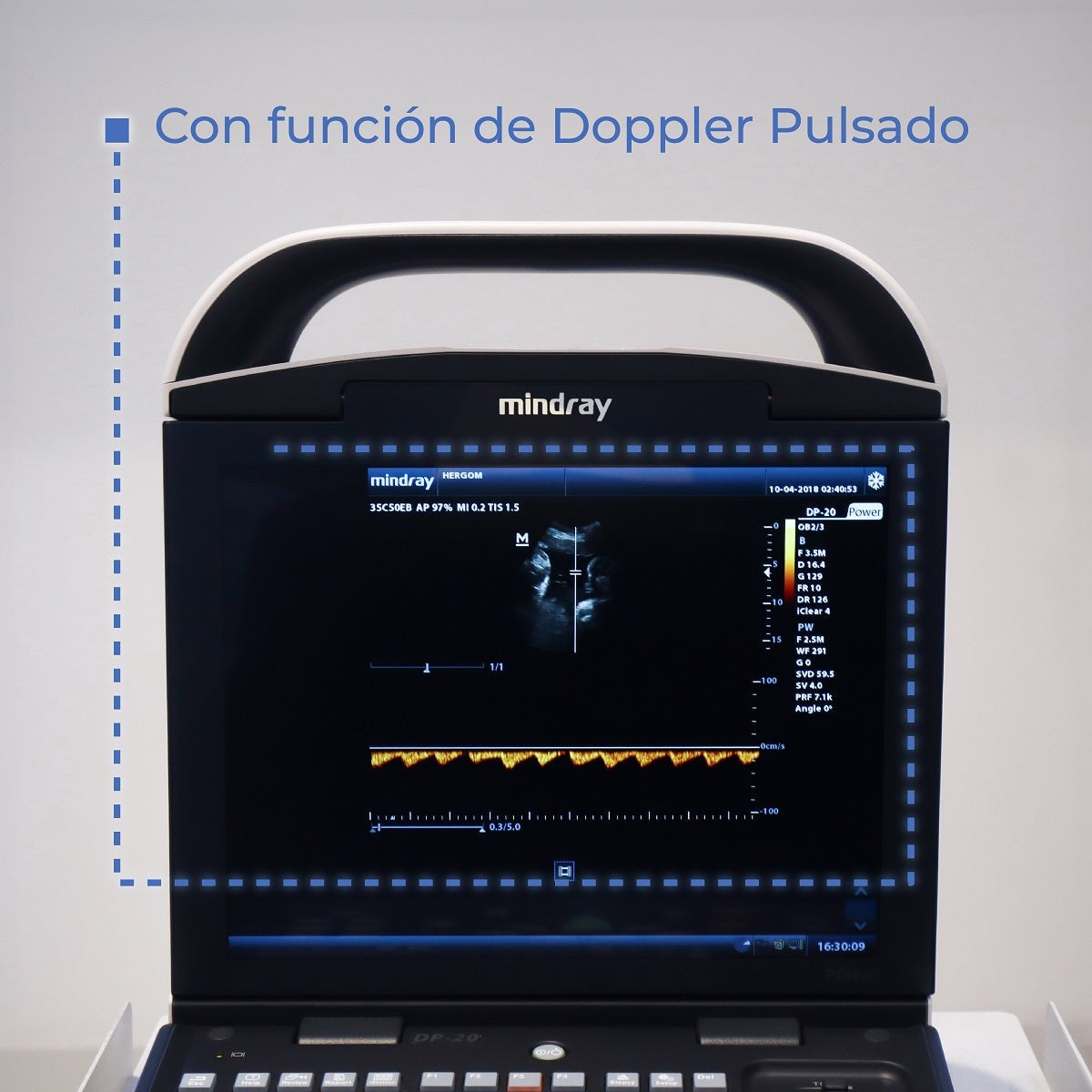 Ultrasonido Portátil para Uso Humano DP20 con función Doppler Pulsado y mejoradores de imagen iBeam y iClear Mindray