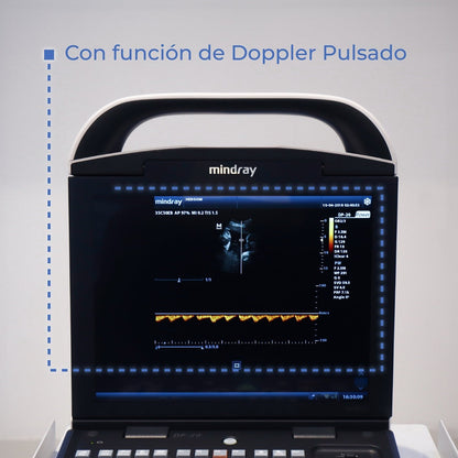 Ultrasonido Portátil para Uso Humano DP20 con función Doppler Pulsado y mejoradores de imagen iBeam y iClear Mindray